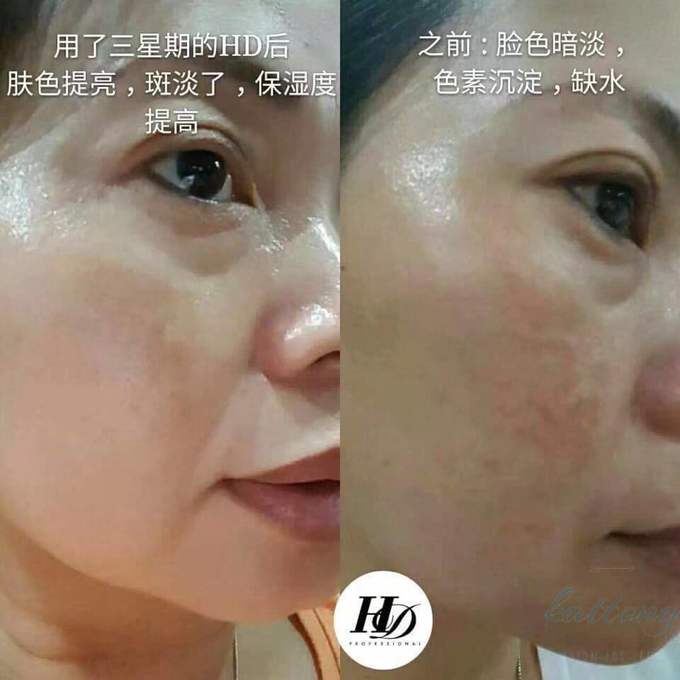 Fly Up HD Vitamin C Serum Dark Spot Corrector - fly up beauty HD makeup professional make up kattong 