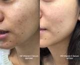 Fly Up HD Vitamin C Serum Dark Spot Corrector - fly up beauty HD makeup professional make up kattong 